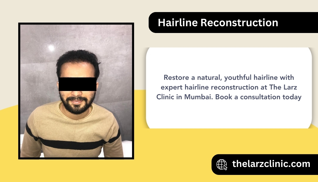 hairline-reconstruction-mira-road-mumbai